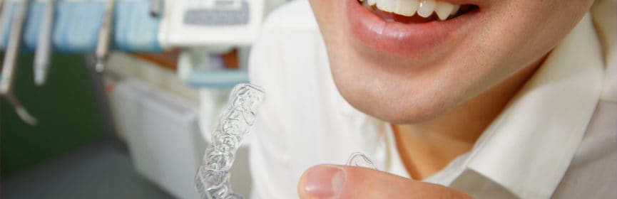 How Mouthguards Prevent Sports Injuries to Teeth
