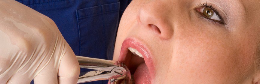 Difficult Tooth Extraction