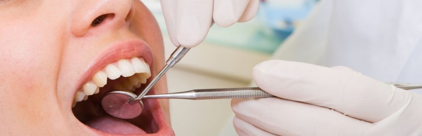 Everything You Need To Know About Your Dental Checkup