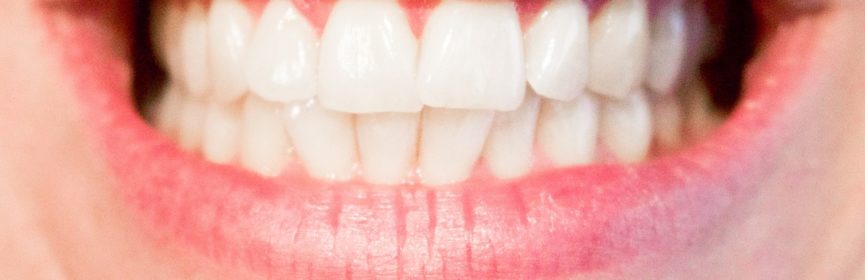 Treatment of Bruxism Available in Thornhill