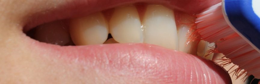 Best Non-Surgical Gum Therapy in Thornhill