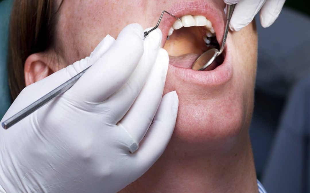 Thornhill Dentist : Taking Care of Your Teeth at Home