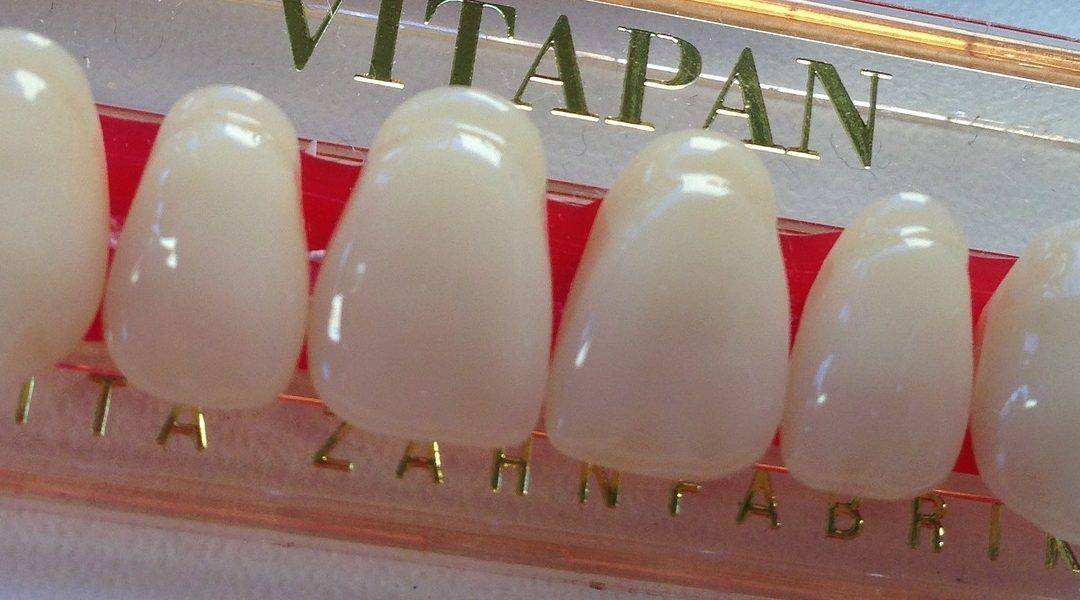 Dental Veneers: Your Primary Solution To Instant Perfect Teeth