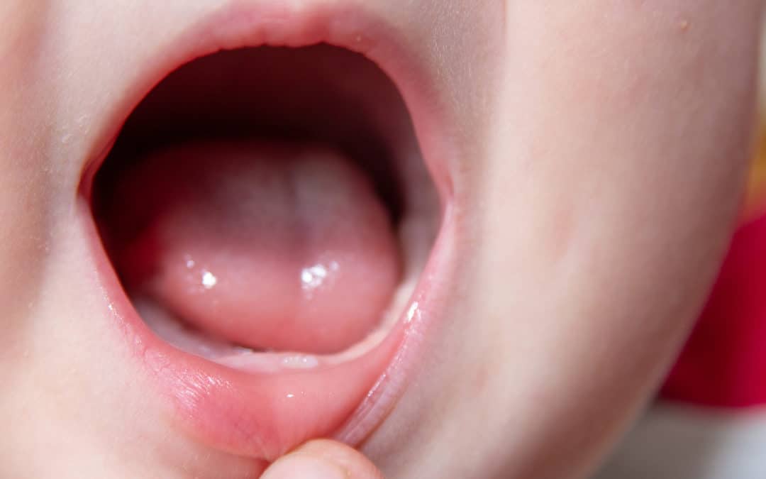 Ensuring Your Child’s Future With Infant Oral Exams