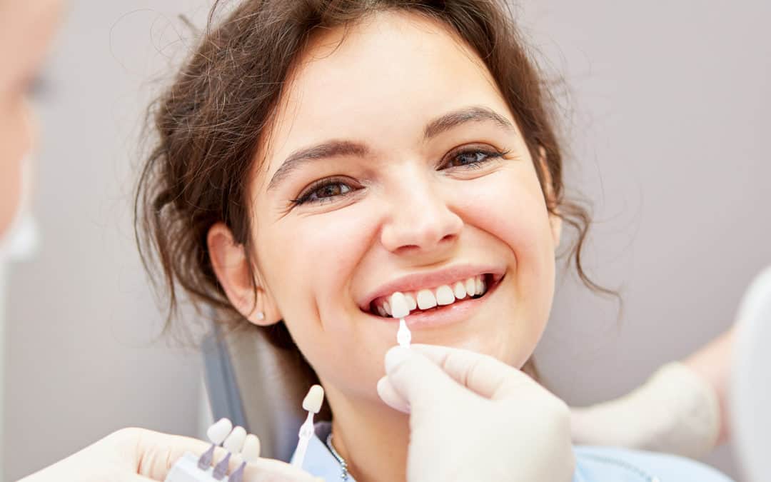 Cosmetic Dental Bonding: An Ideal Solution To Your Smile?