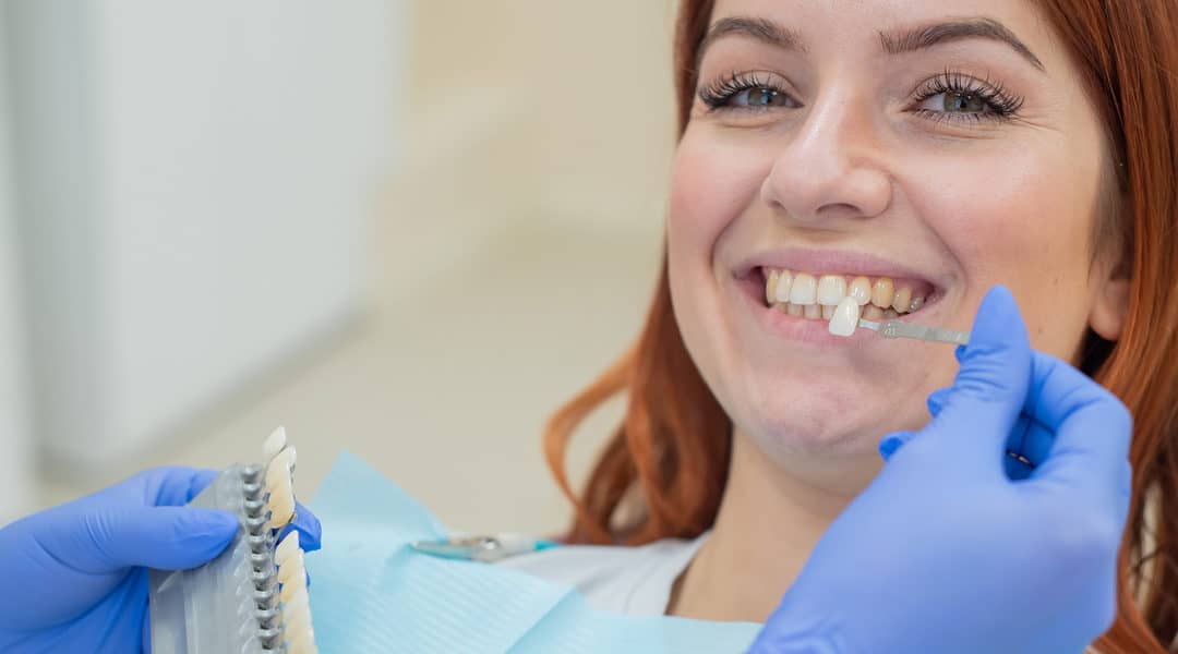 Veneers Vs Dental Bonding: Which Treatment Suits You Best