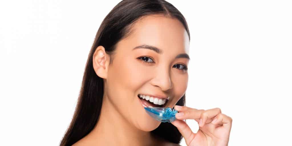 mouthguard - Thornhill dentists by World Dental
