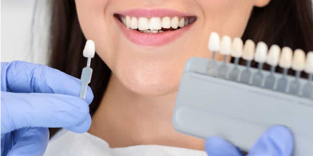 dentist holdingn tooth shade for veneers - Thornhill dentists by World Dental