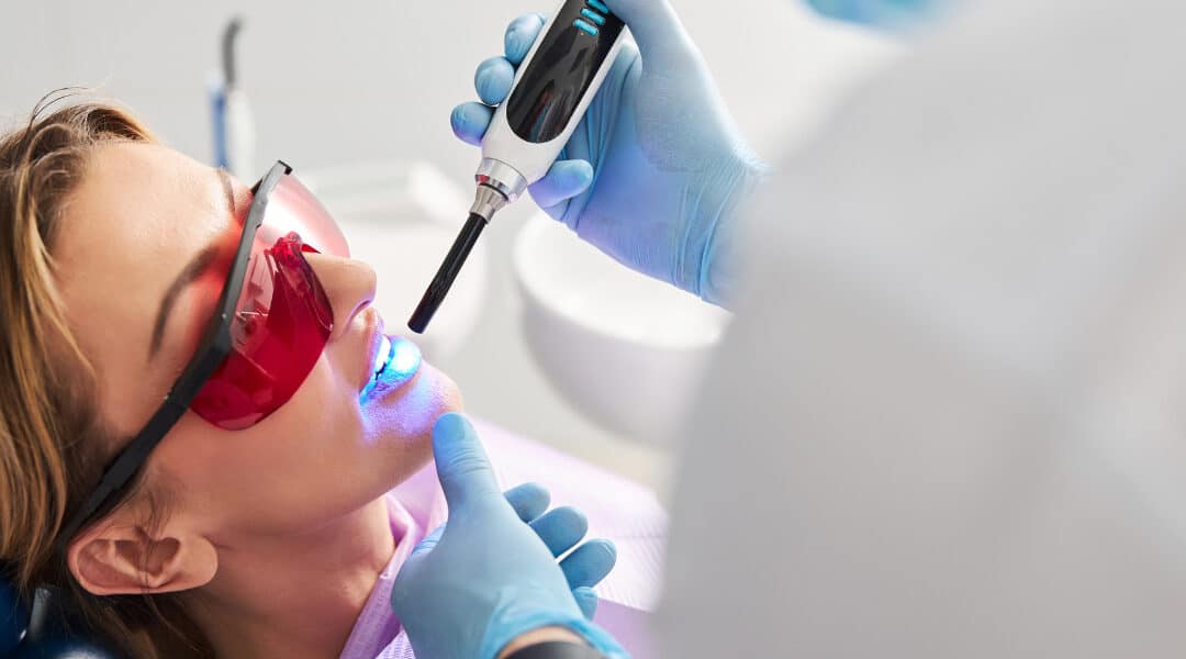 Bye To Cavities: How Dental Sealants In Thornhill Can Help