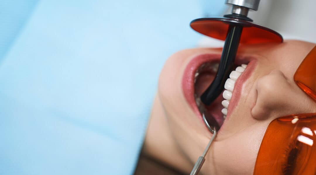 Debunking 5 Common Myths On Root Canal Therapy | Thornhill