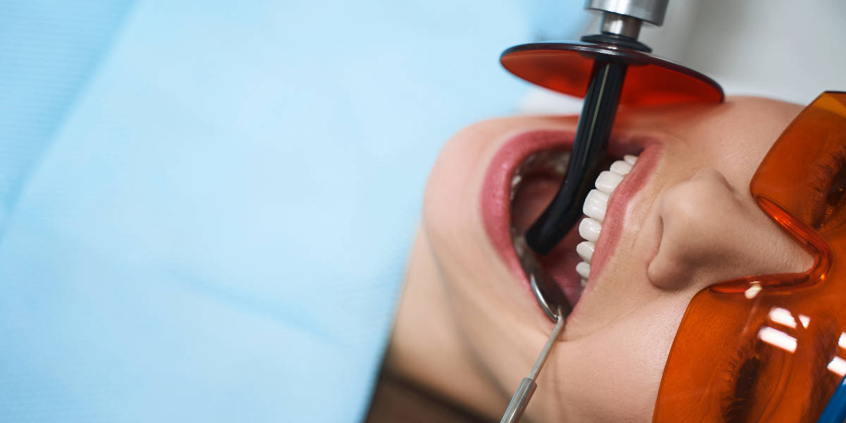 Root canal therapy in Thornhill dental office