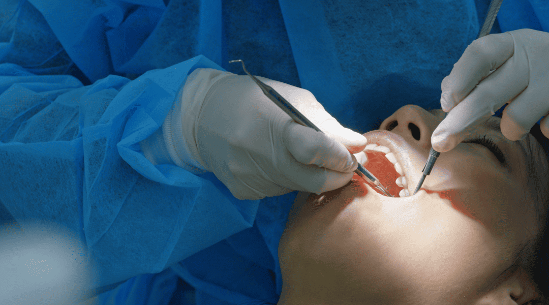 5 Major Things To Avoid After Tooth Extraction Surgery