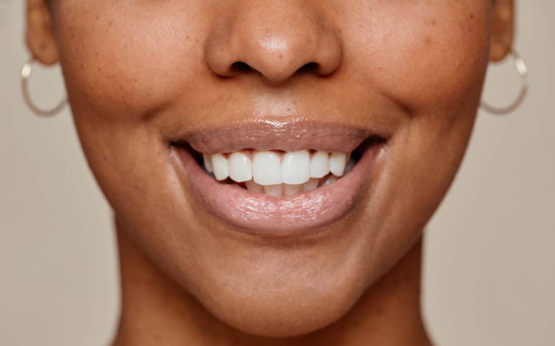 How to Keep Teeth Clean and Healthy: Expert Tips and Tricks