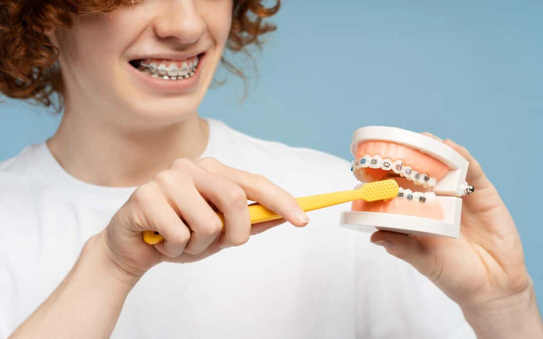 How to Clean Teeth with Braces: A Guide for Keeping Your Smile Bright