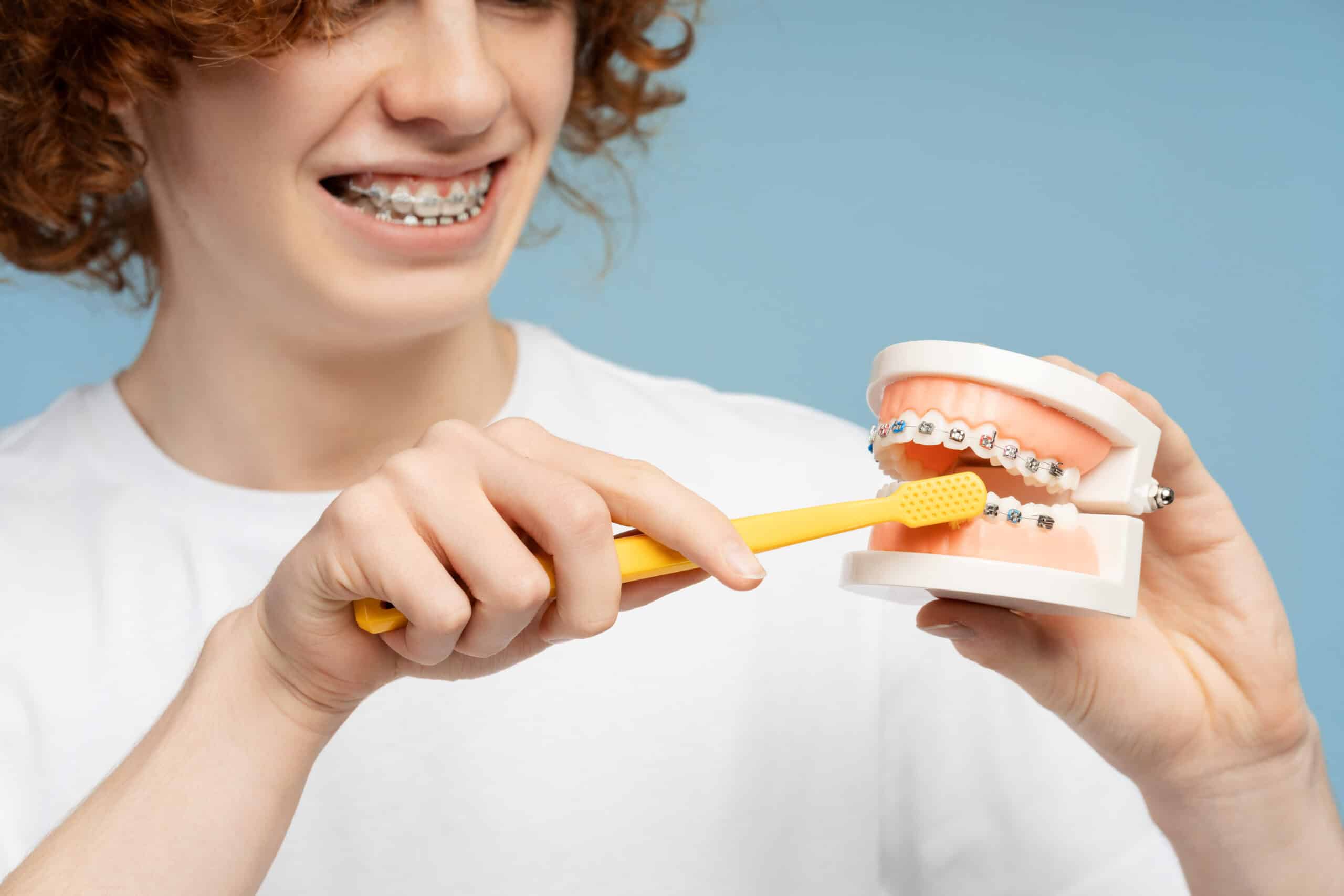 How to Clean Teeth with Braces: A Guide for Keeping Your Smile Bright