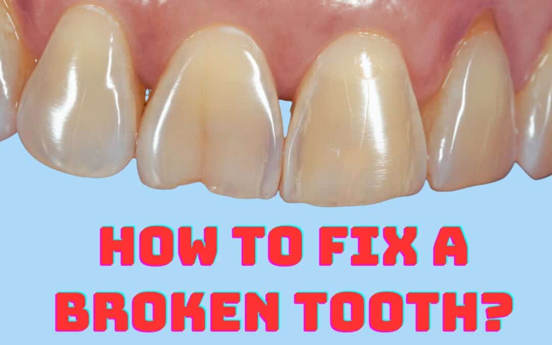 How to Fix a Broken Tooth – Immediate Steps and Professional Treatment Options