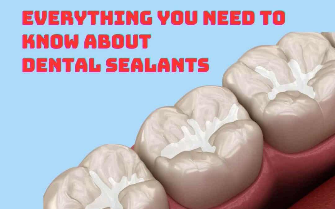 dental sealants