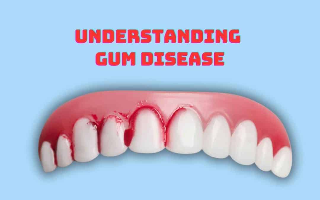 Understanding Gum Disease: Symptoms, Causes, and Treatments